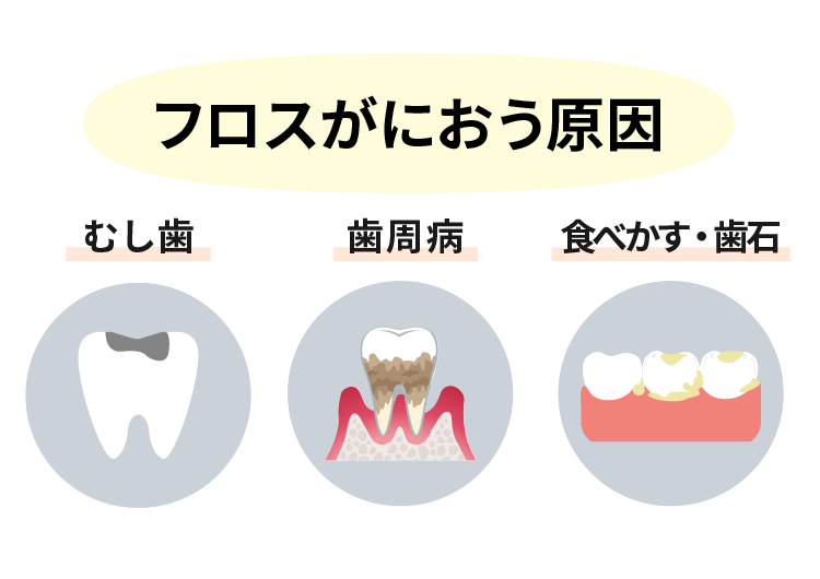 デンタルフロスが臭い！原因と対処法は？ | 大阪・北浜の歯医者さん